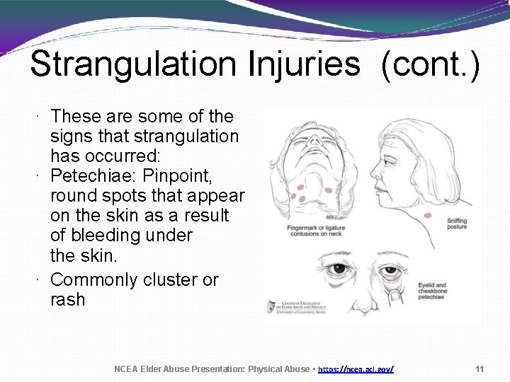 Strangulation Injuries (cont. ) · These are some of the signs that strangulation has