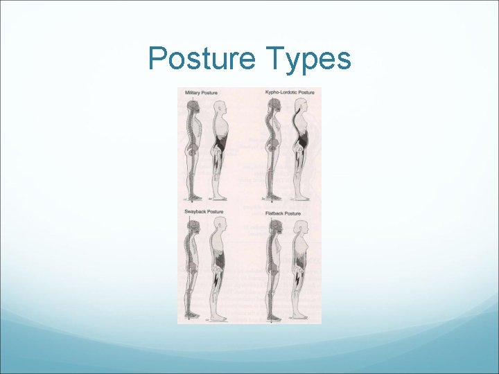 Posture Types 