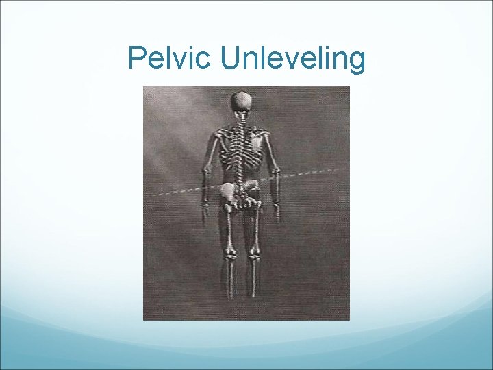 Pelvic Unleveling 