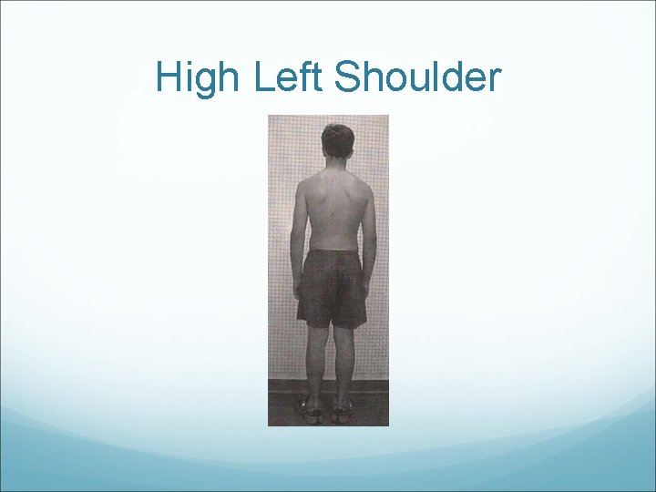 High Left Shoulder 