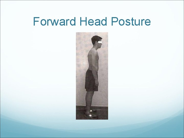 Forward Head Posture 