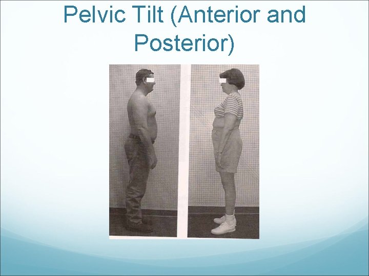 Pelvic Tilt (Anterior and Posterior) 