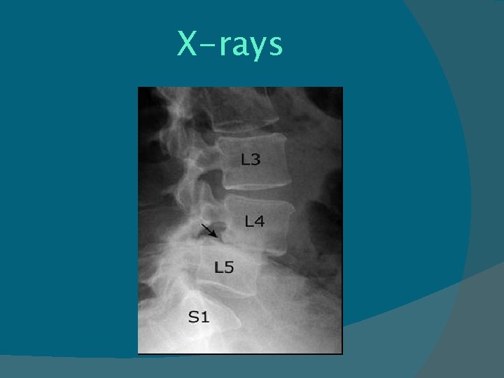 X-rays 