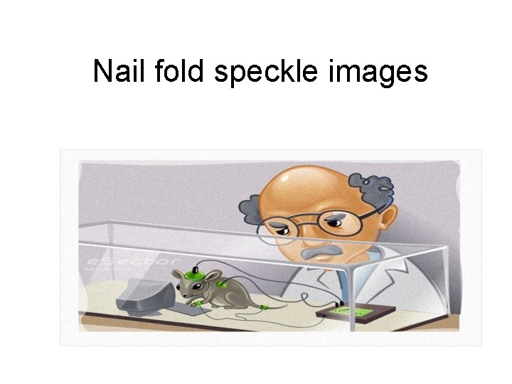 Nail fold speckle images 