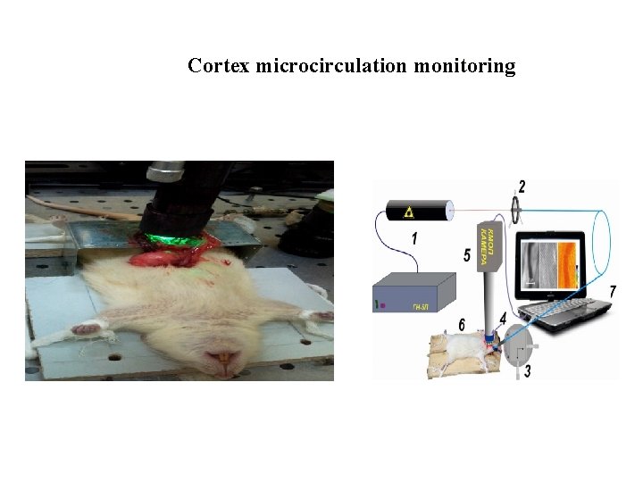 Cortex microcirculation monitoring 