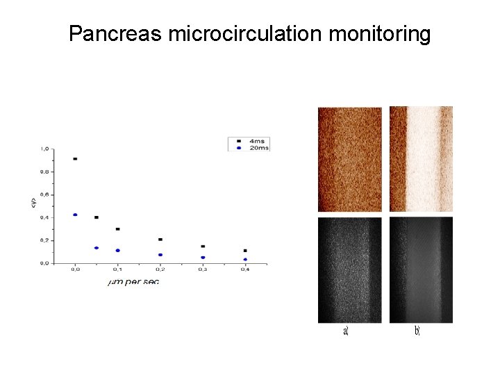 Pancreas microcirculation monitoring 