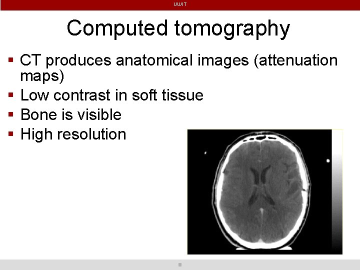 UU/IT Computed tomography CT produces anatomical images (attenuation maps) Low contrast in soft tissue