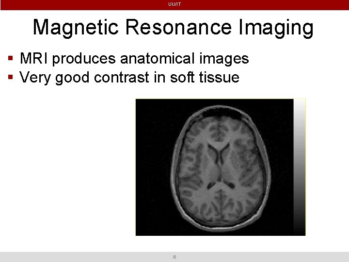 UU/IT Magnetic Resonance Imaging MRI produces anatomical images Very good contrast in soft tissue