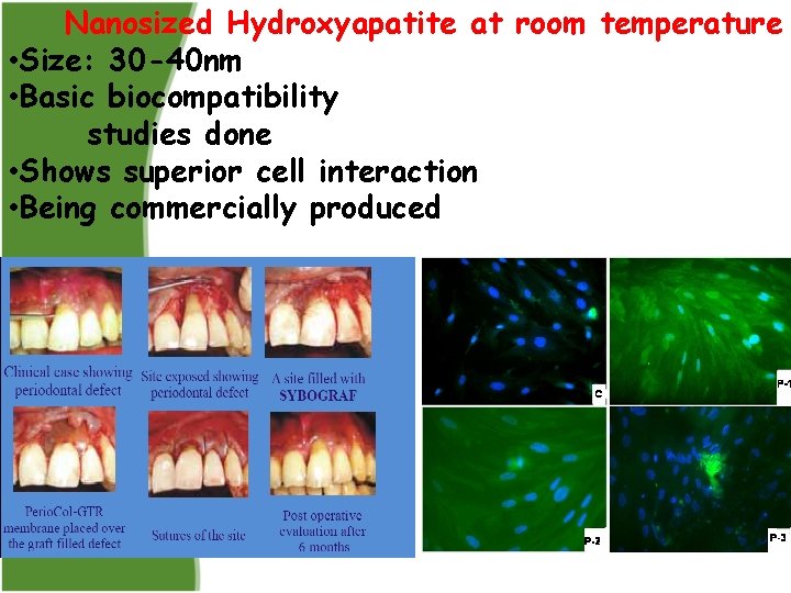 Nanosized Hydroxyapatite at room temperature • Size: 30 -40 nm • Basic biocompatibility studies