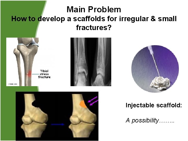 Main Problem How to develop a scaffolds for irregular & small fractures? Injectable scaffold: