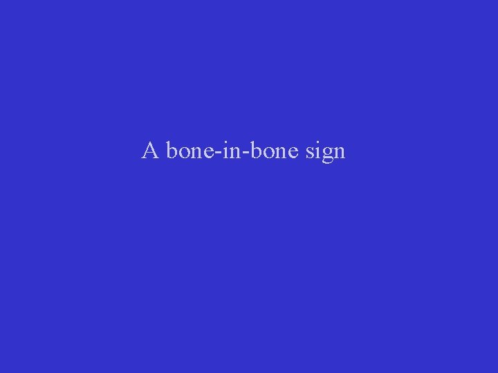 A bone-in-bone sign 