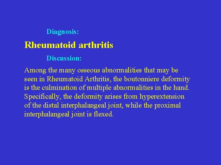 Diagnosis: Rheumatoid arthritis Discussion: Among the many osseous abnormalities that may be seen in