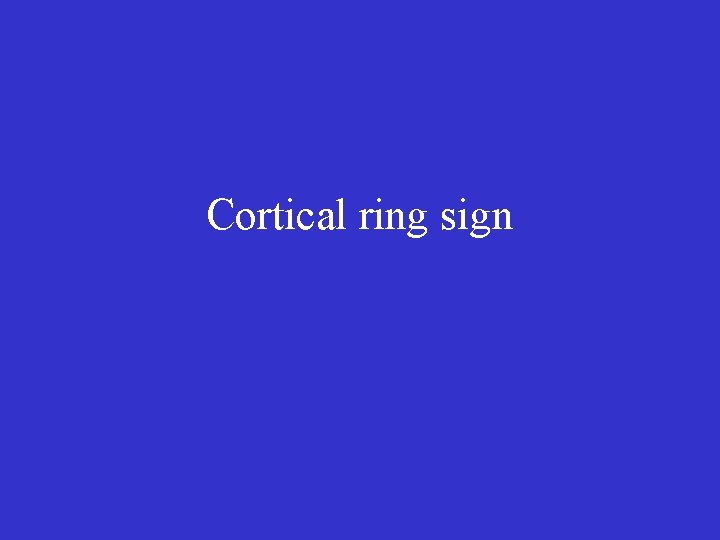 Cortical ring sign 