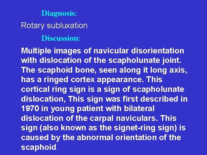 Diagnosis: Rotary subluxation Discussion: Multiple images of navicular disorientation with dislocation of the scapholunate