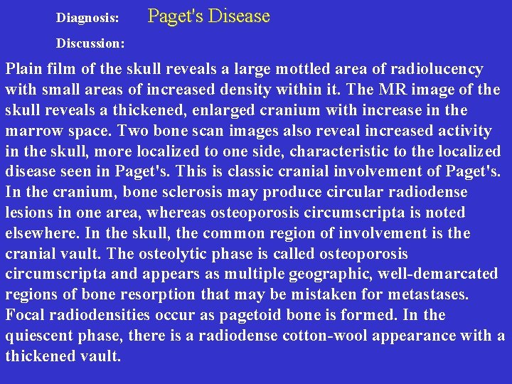 Diagnosis: Paget's Disease Discussion: Plain film of the skull reveals a large mottled area