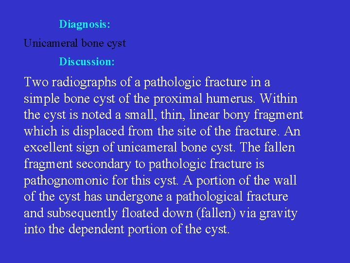 Diagnosis: Unicameral bone cyst Discussion: Two radiographs of a pathologic fracture in a simple