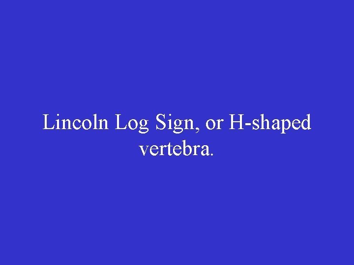 Lincoln Log Sign, or H-shaped vertebra. 
