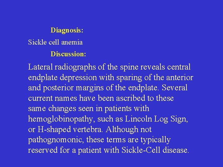 Diagnosis: Sickle cell anemia Discussion: Lateral radiographs of the spine reveals central endplate depression