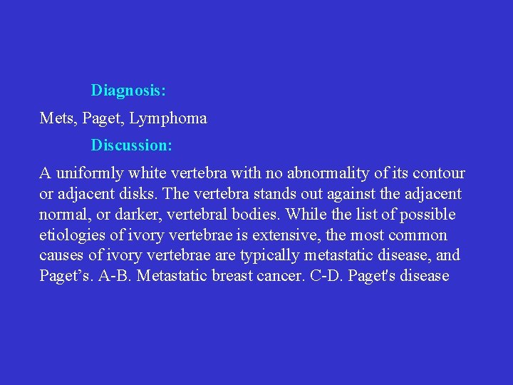 Diagnosis: Mets, Paget, Lymphoma Discussion: A uniformly white vertebra with no abnormality of its