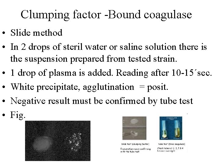 Clumping factor -Bound coagulase • Slide method • In 2 drops of steril water