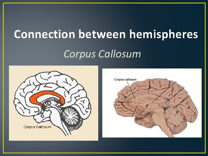 Connection between hemispheres Corpus Callosum 