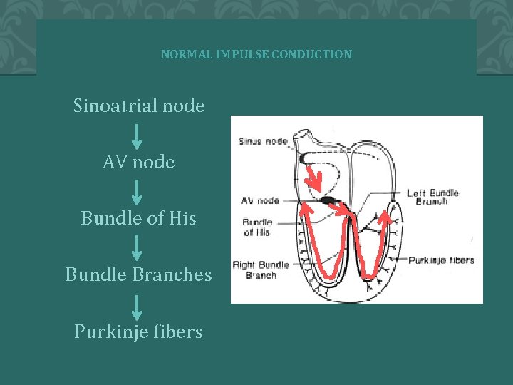 NORMAL IMPULSE CONDUCTION Sinoatrial node AV node Bundle of His Bundle Branches Purkinje fibers