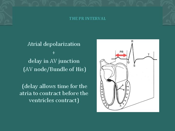 THE PR INTERVAL Atrial depolarization + delay in AV junction (AV node/Bundle of His)