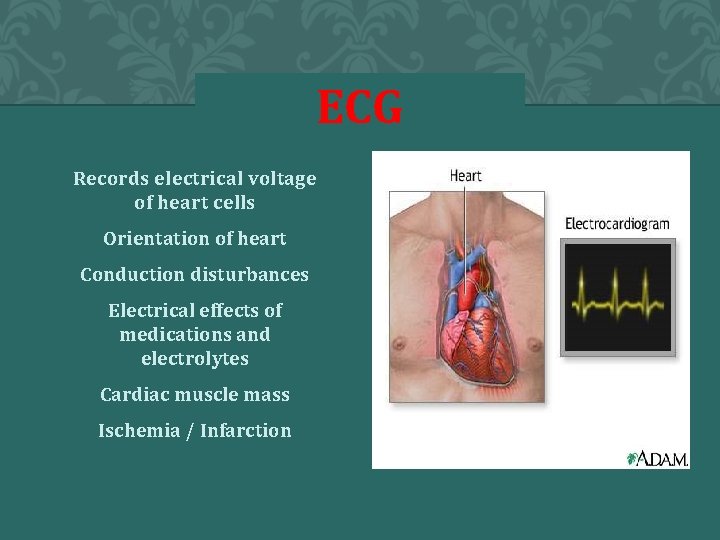 ECG Records electrical voltage of heart cells Orientation of heart Conduction disturbances Electrical effects