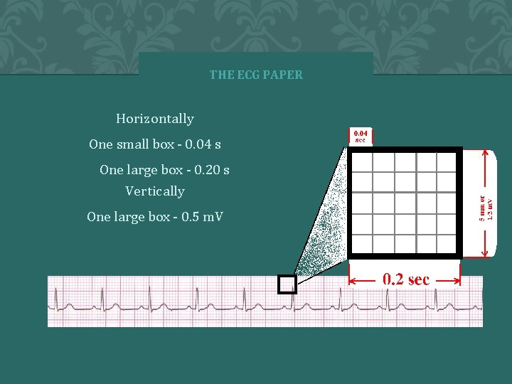 THE ECG PAPER Horizontally One small box - 0. 04 s 1. One large