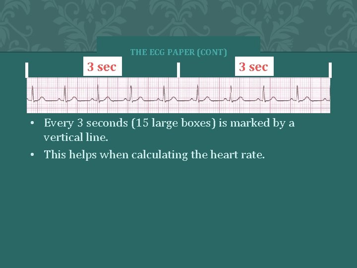 THE ECG PAPER (CONT) 3 sec • Every 3 seconds (15 large boxes) is