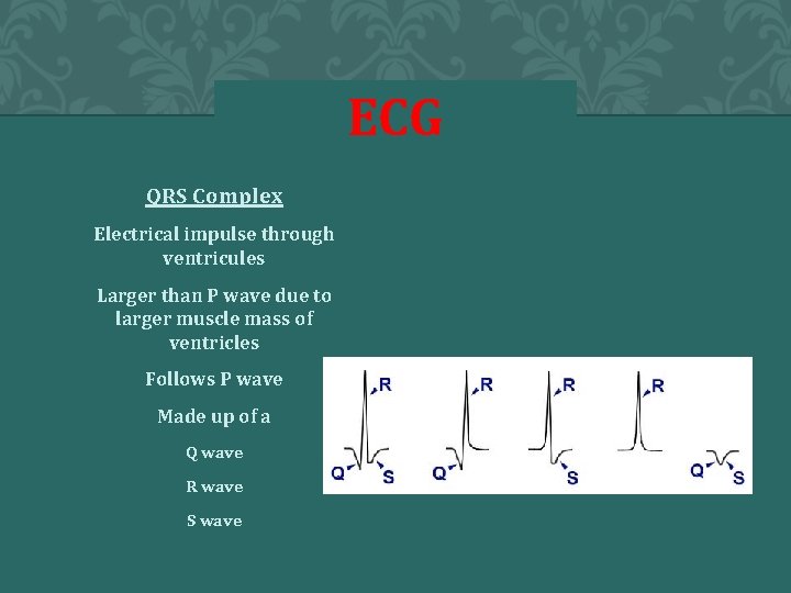 ECG QRS Complex Electrical impulse through ventricules Larger than P wave due to larger