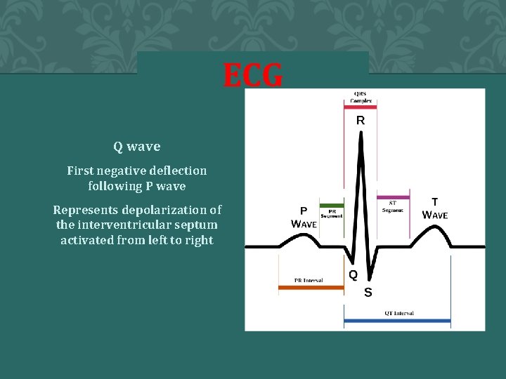 ECG Q wave First negative deflection following P wave Represents depolarization of the interventricular