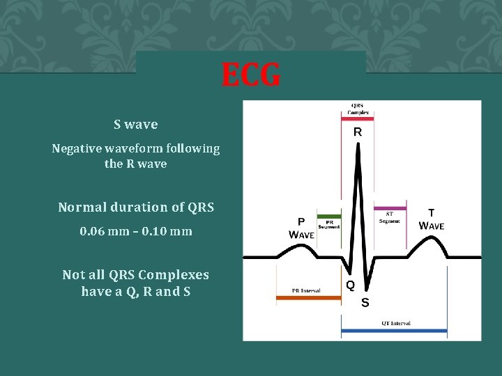 ECG S wave Negative waveform following the R wave Normal duration of QRS 0.