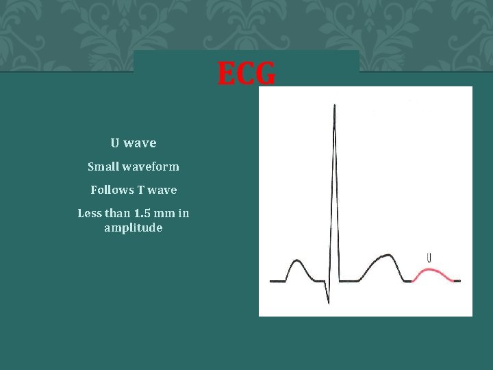 ECG U wave Small waveform Follows T wave Less than 1. 5 mm in