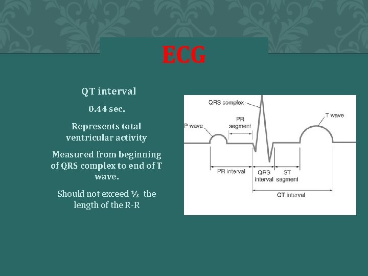 ECG a. QT interval a. 0. 44 sec. b. Represents total ventricular activity c.