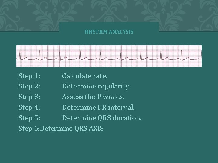 RHYTHM ANALYSIS Step 1: Calculate rate. Step 2: Determine regularity. Step 3: Assess the RHYTHM ANALYSIS Step 1: Calculate rate. Step 2: Determine regularity. Step 3: Assess the