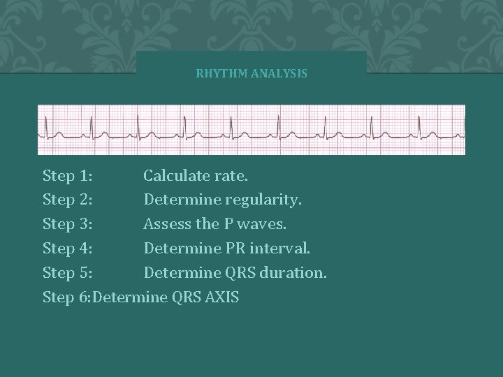 RHYTHM ANALYSIS Step 1: Calculate rate. Step 2: Determine regularity. Step 3: Assess the