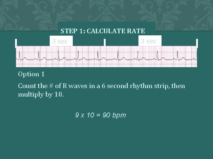 STEP 1: CALCULATE RATE 3 sec Option 1 Count the # of R waves