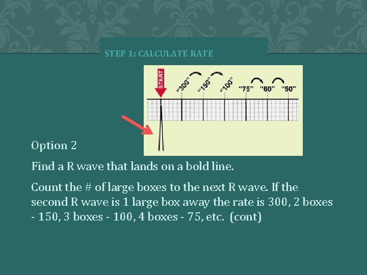 STEP 1: CALCULATE R wave Option 2 Find a R wave that lands on