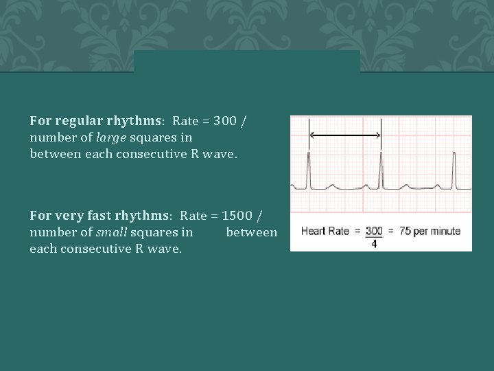 For regular rhythms: Rate = 300 / number of large squares in between each