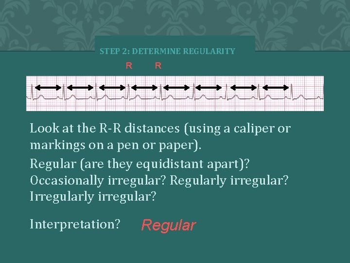 STEP 2: DETERMINE REGULARITY R R Look at the R-R distances (using a caliper