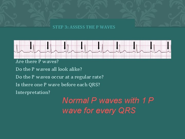 STEP 3: ASSESS THE P WAVES Are there P waves? Do the P waves