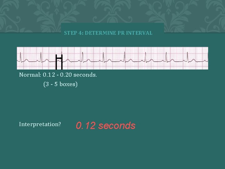 STEP 4: DETERMINE PR INTERVAL Normal: 0. 12 - 0. 20 seconds. (3 -