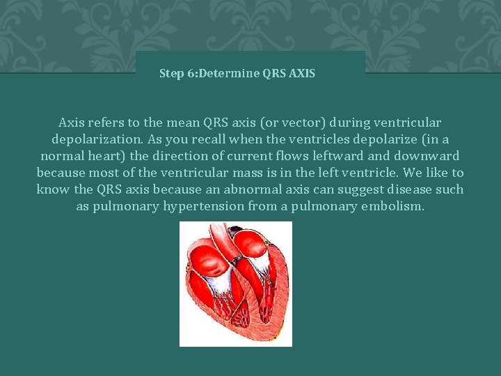 Step 6: Determine QRS AXIS Axis refers to the mean QRS axis (or vector)