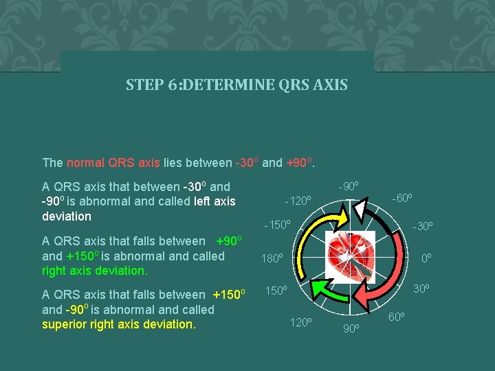 STEP 6: DETERMINE QRS AXIS The normal QRS axis lies between -30 o and