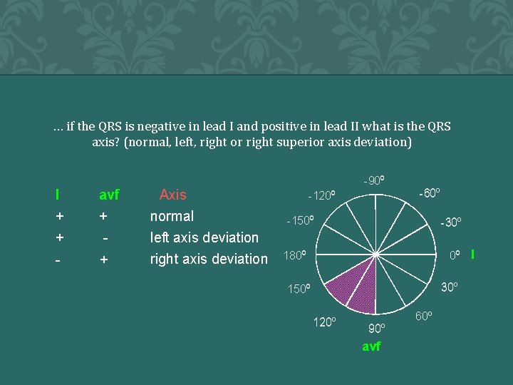 … if the QRS is negative in lead I and positive in lead II