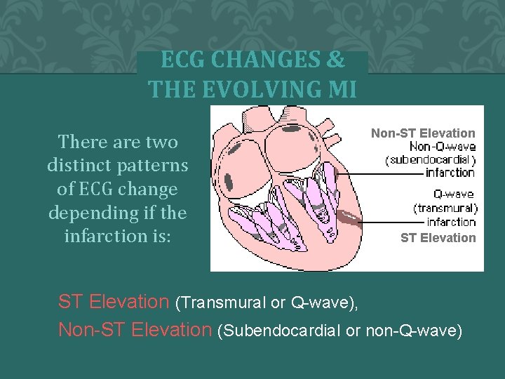 ECG CHANGES & THE EVOLVING MI There are two distinct patterns of ECG change