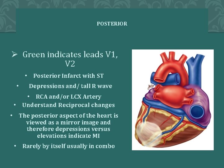 POSTERIOR Ø Green indicates leads V 1, V 2 • Posterior Infarct with ST