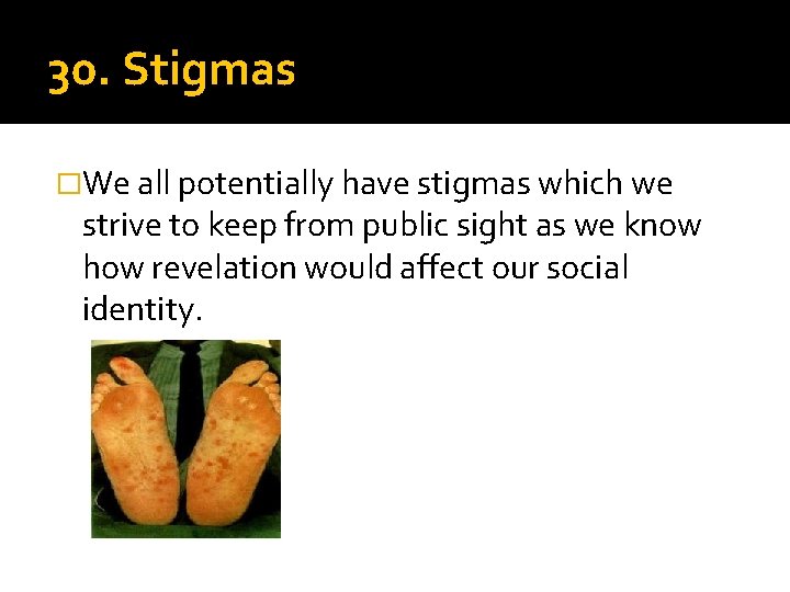 30. Stigmas �We all potentially have stigmas which we strive to keep from public