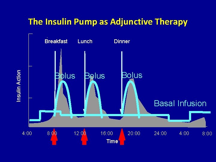 The Insulin Pump as Adjunctive Therapy Insulin Action Breakfast Lunch Bolus Dinner Bolus Basal